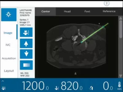 Philips Incisive CT — Биопсия под контролем КТ