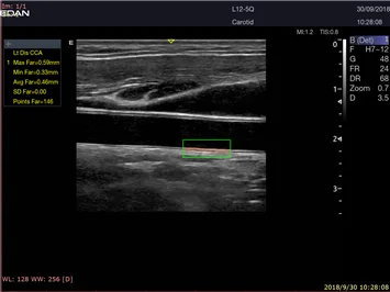 EDAN Acclarix LX9 — Клинические изображения Acclarix LX9 — фото 10