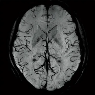 Fujifilm ECHELON Smart 1.5T — Клинические изображения ECHELON Smart — фото 3