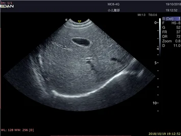 EDAN Acclarix LX9 — Клинические изображения Acclarix LX9 — фото 12