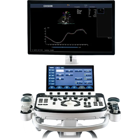 CHISON XBit 90