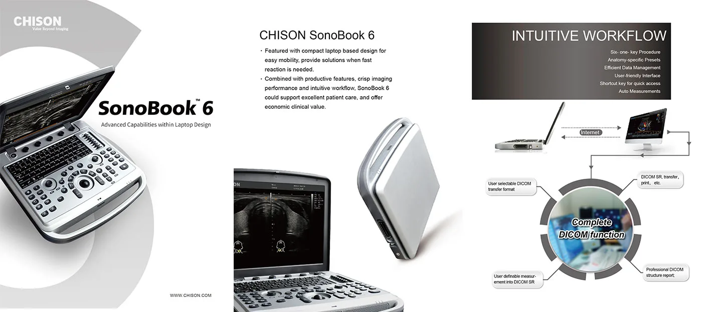 CHISON SonoBook 6 — Рабочий процесс и выгрузка исследований