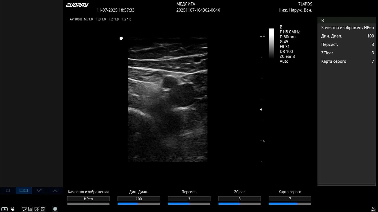 EVORAY USS 40 — Клинические изображения EVORAY USS 40 — фото 10