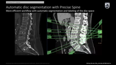 Philips Incisive CT — Клинические изображения — фото 1