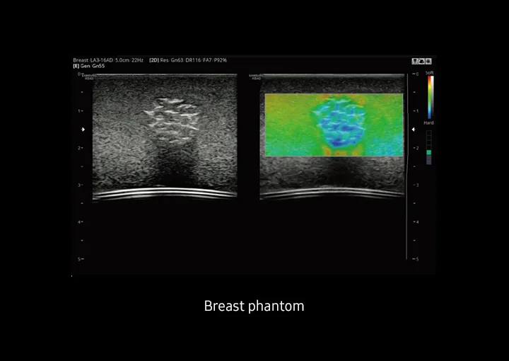 Samsung HS40 — ElastoScan: жёсткость тканей в цвете