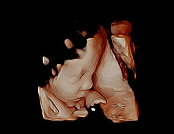 CHISON QBit 9 — Акушерство и 4D: Virtual HD и Depth View — фото 3