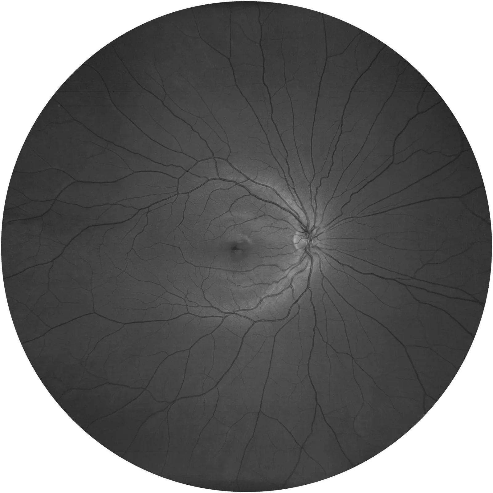 ZEISS CLARUS 700 — Три канала одного снимка