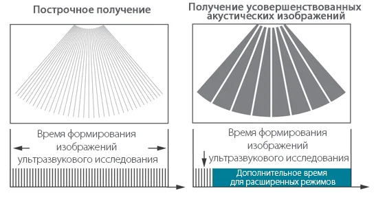 Mindray Resona 7 — Сканирование в 10 раз быстрее