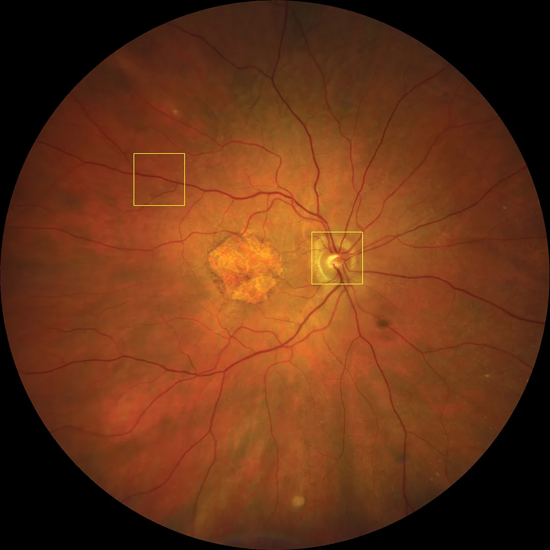 ZEISS CLARUS 700 — Автоматика, которая экономит время у прибора — фото 1