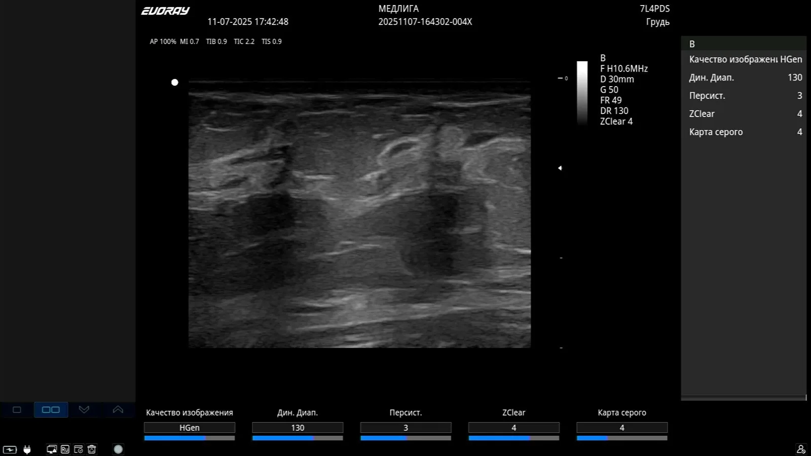 EVORAY USS 40 — Клинические изображения EVORAY USS 40 — фото 7