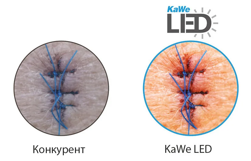 KaWe MASTERLIGHT LED 3000 — Цветопередача Ra 96