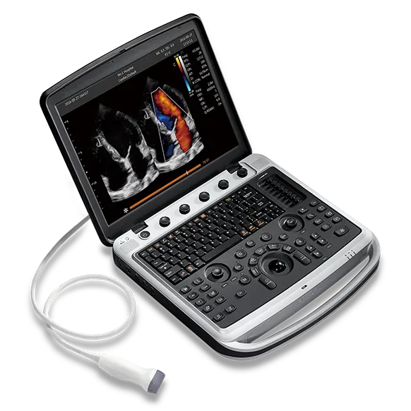 CHISON SonoBook 9