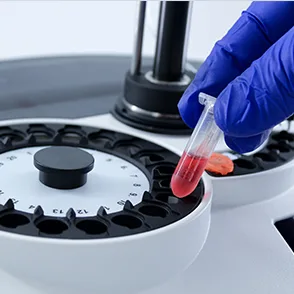 EKF Diagnostics Biosen C-Line GP+ — Три шага до результата