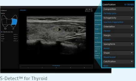 Samsung V8 — S-Detect: молочная и щитовидная железы