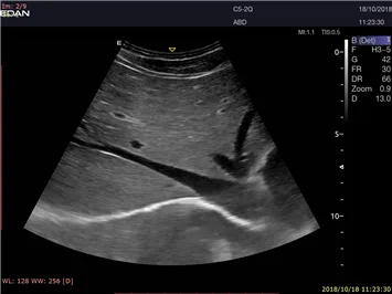 EDAN Acclarix LX9 — Клинические изображения Acclarix LX9 — фото 5