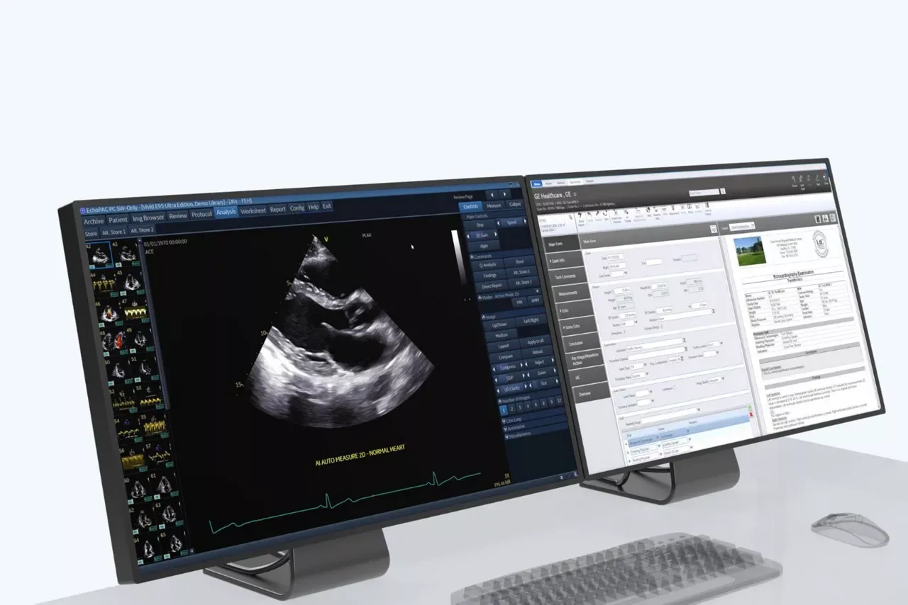 GE Vivid iQ — EchoPAC: анализ и отчёты из любой точки