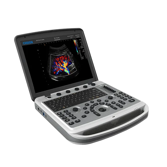 CHISON SonoBook 6