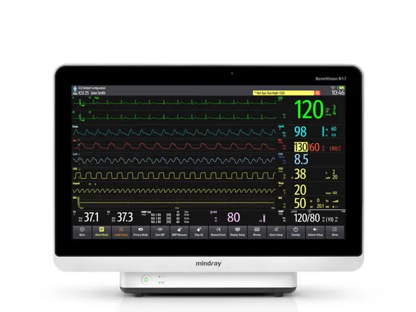 Mindray BeneVision N17