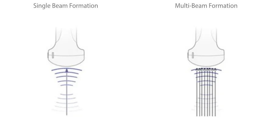 Mindray M6 — Многолучевое формирование