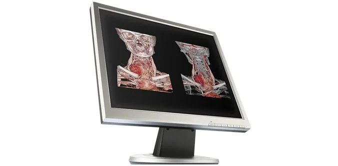 Canon Aquilion Lightning — Реконструкция 15 изображений в секунду