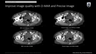 Philips Incisive CT — Клинические изображения — фото 4