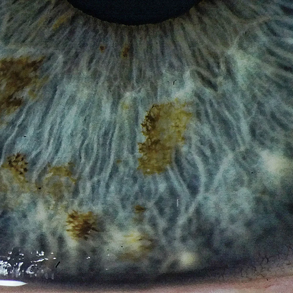 ZEISS SL 800 — TrueView Optics: пять ступеней увеличения 6–40× — фото 3
