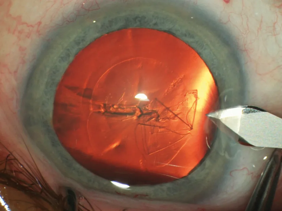 Haag-Streit Surgical HS Hi-R NEO 900 — C.RED 900 — красный рефлекс по потребности