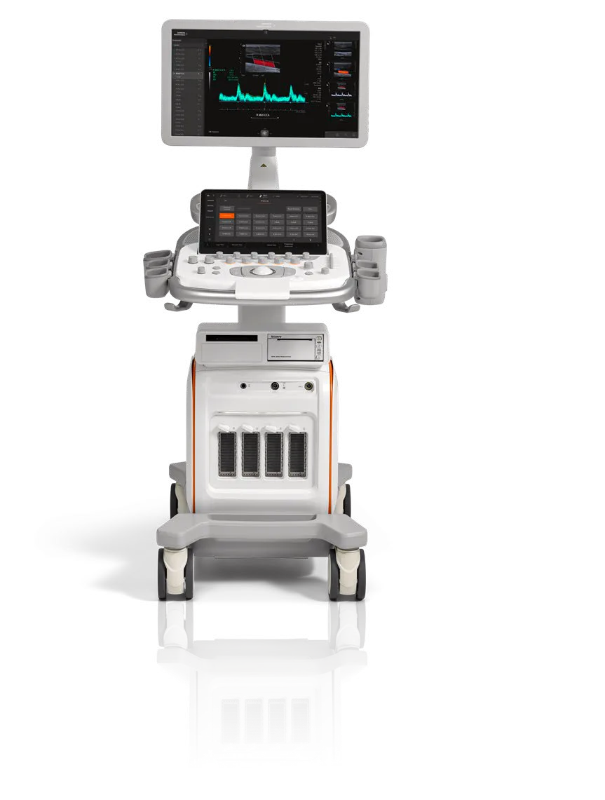 Siemens ACUSON Redwood