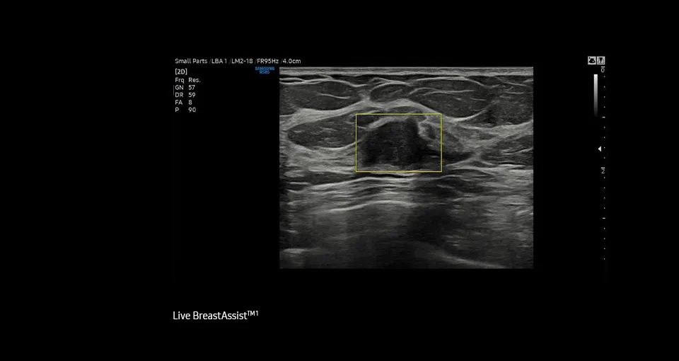Samsung RS85 — Live BreastAssist: ИИ следит за молочной железой