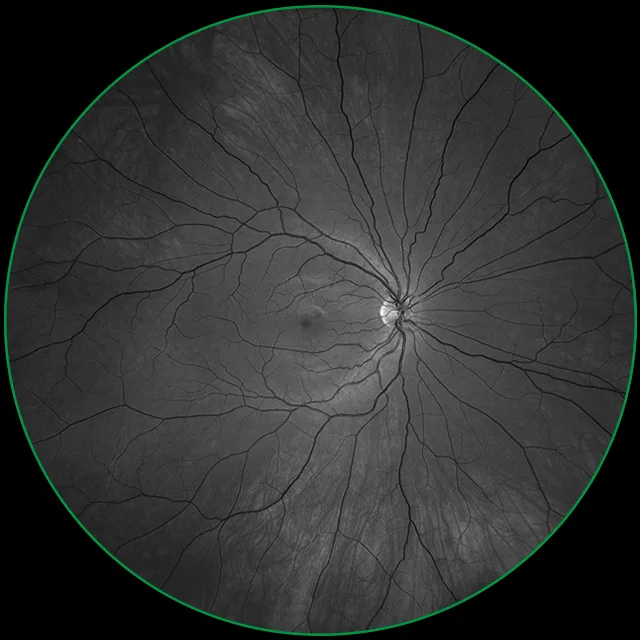 ZEISS CLARUS 500 — Разбор снимка на красный, зелёный и синий