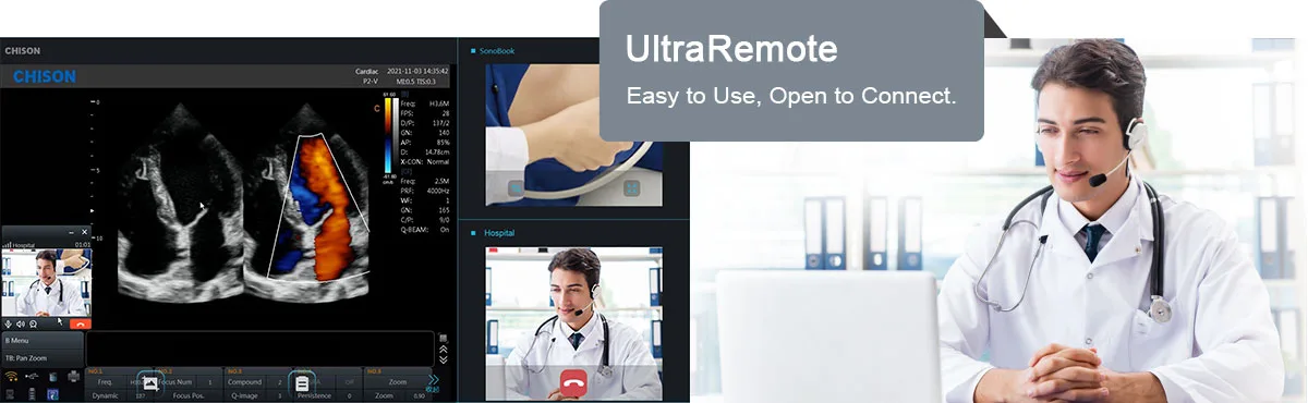 CHISON SonoBook 9 — UltraRemote: подключение коллеги к исследованию