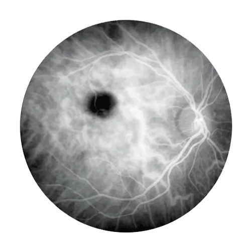 ZEISS VISUCAM 524 — Ангиография с индоцианином — опция