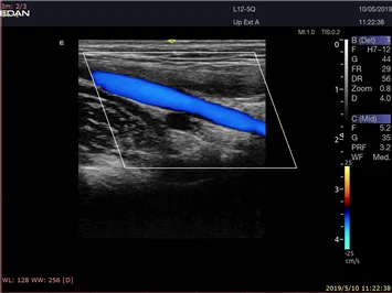 EDAN Acclarix LX9 — Клинические изображения Acclarix LX9 — фото 4