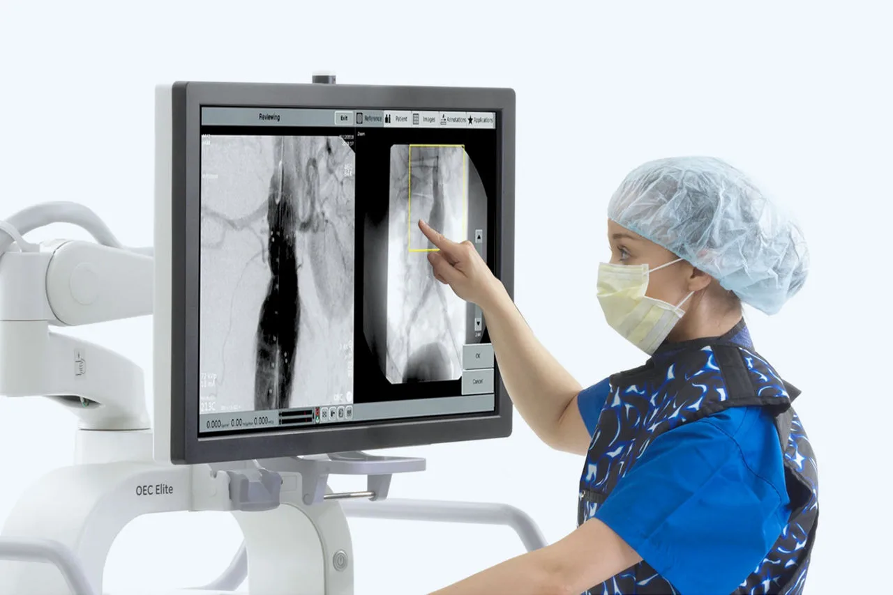 GE HealthCare OEC Elite CFD — Плоский КМОП-детектор вместо усилителя изображения