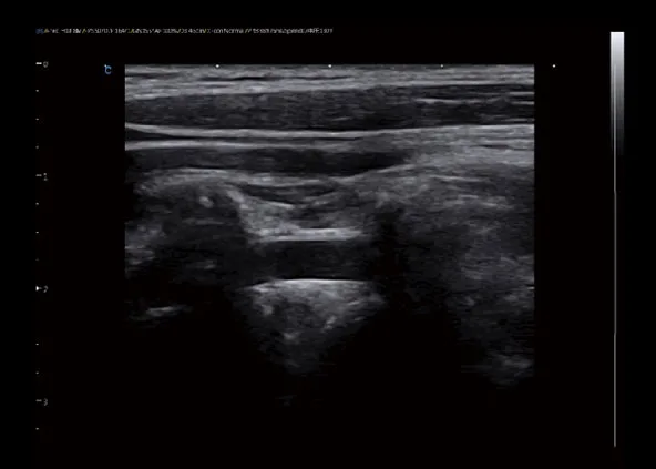 CHISON CBit 9 — Клинические изображения CBit 9 — фото 9