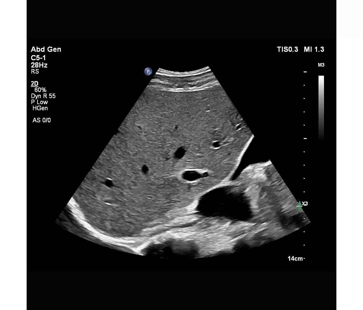 Philips EPIQ Elite — Auto Scan нового поколения