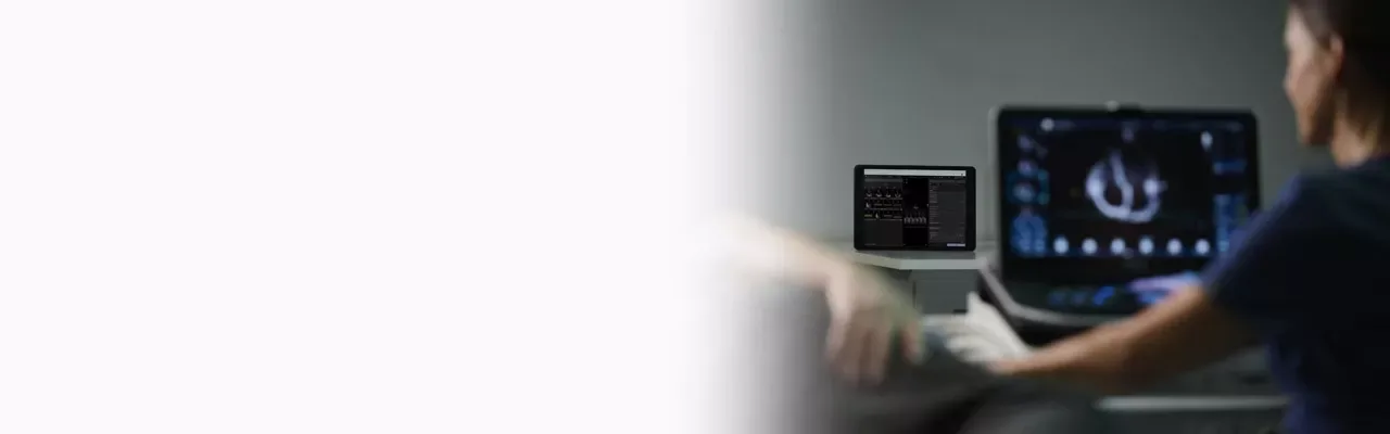 GE Vivid iQ — EchoPAC: анализ и отчёты из любой точки