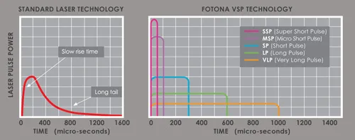 Fotona SP Dynamis — Режим Fotona SMOOTH: нагрев без абляции