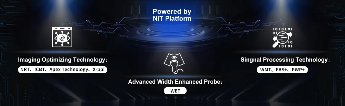 CHISON XBit 90 — Платформа NIT: новая архитектура обработки