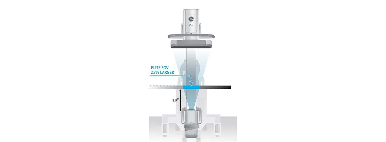 GE HealthCare OEC Elite CFD — Поле обзора на 22 % больше, чем у моноблоков