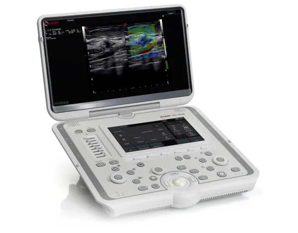 Esaote MyLab Omega