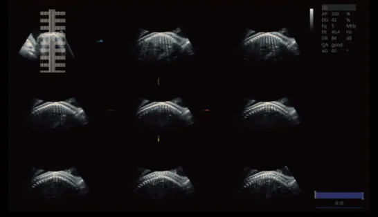 VINNO X1 — 4D с MCut и гибкий вывод на экран