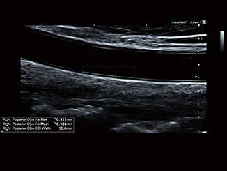 Canon Aplio a — Altivity: ИИ-функции в рабочем процессе