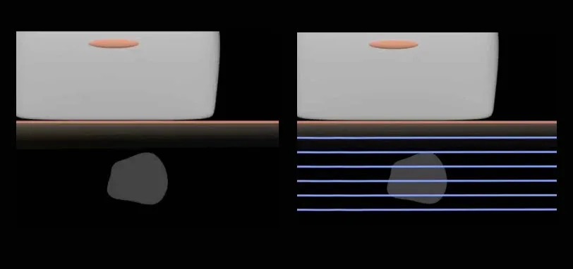 Canon Aplio i700 — Эластография сдвиговой волной и Smart Maps — фото 1