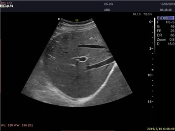 EDAN Acclarix LX9 — Клинические изображения Acclarix LX9 — фото 6