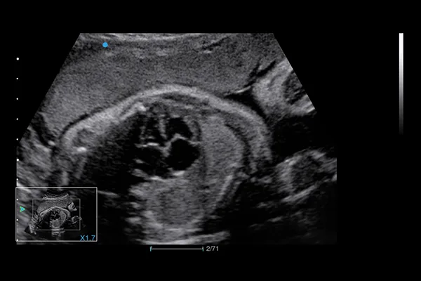 SIUI Apogee 5500 — Клинические изображения — фото 2
