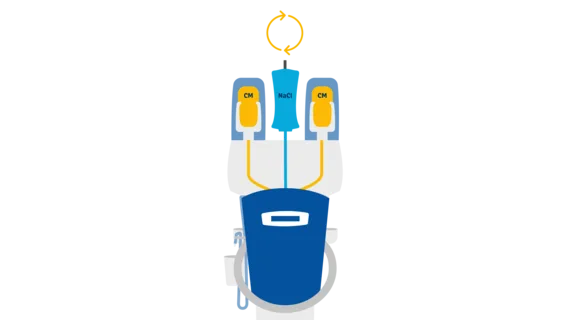Ulrich Medical CT motion SPICY — Seamless и Tandem: два контейнера контраста