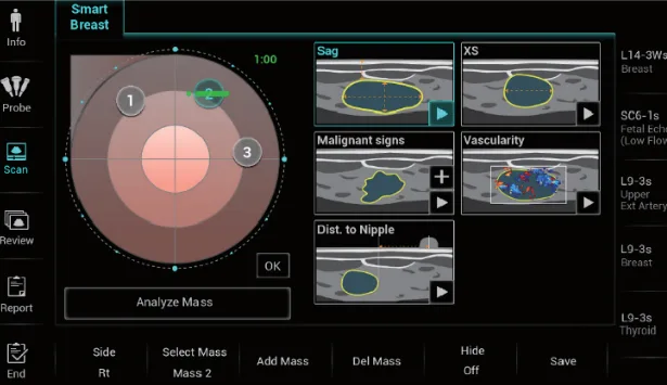 Mindray Resona I9 — Smart Breast — интеллектуальное УЗИ молочных желёз