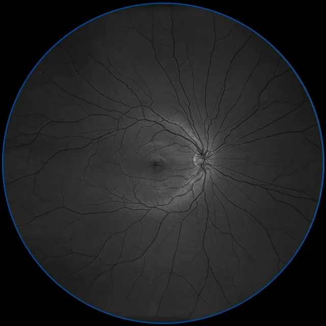 ZEISS CLARUS 500 — Разбор снимка на красный, зелёный и синий