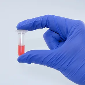 EKF Diagnostics Biosen C-Line GP+ — Три шага до результата